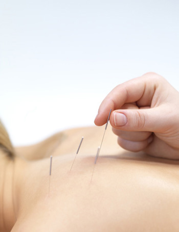 Akupunktur zur Geburtsvorbereitung