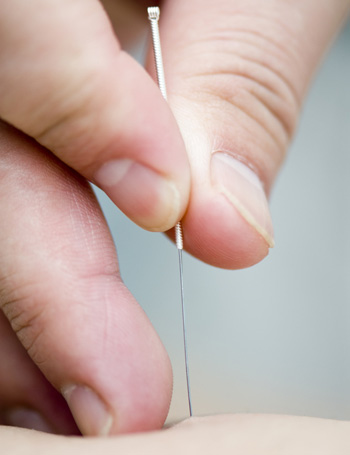 Akupunktursprechstunde